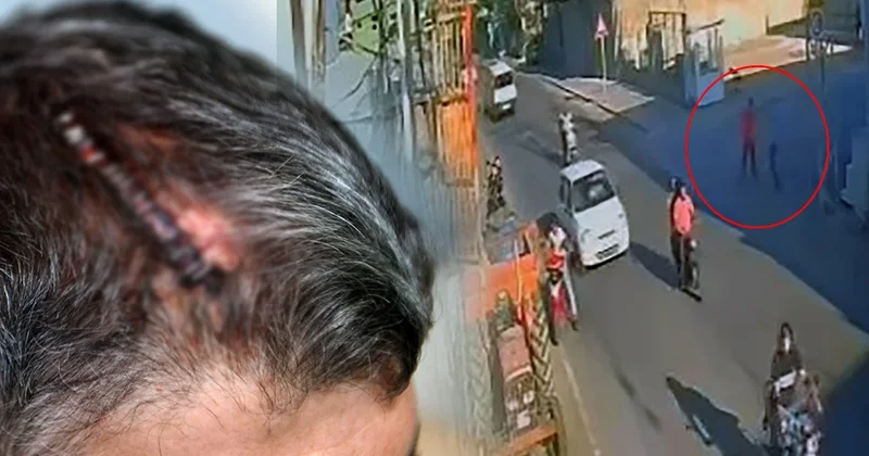 Miras için beyzbol sopasıyla dövüldü: Mahkemenin kararı ile ikinci şoku yaşadı Sözcü Gazetesi