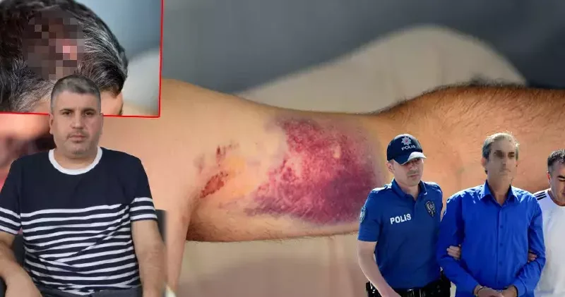 Beyzbol sopasıyla döven dayısı serbest bırakıldı; Can güvenliğim kalmadı