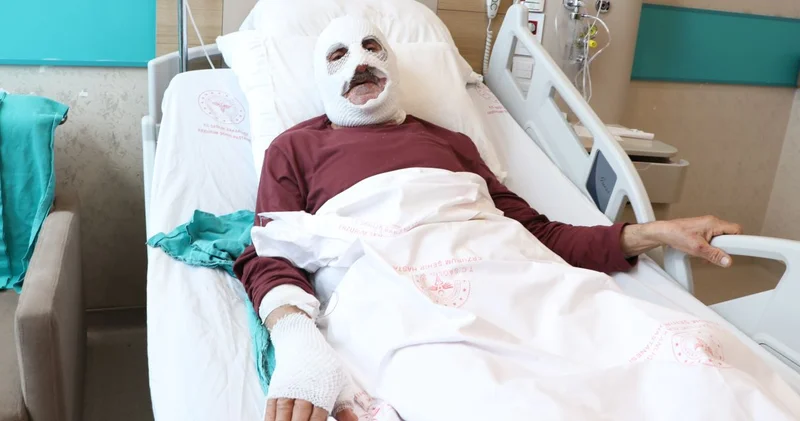Tüpü çakmakla kontrol etti hastanelik oldu