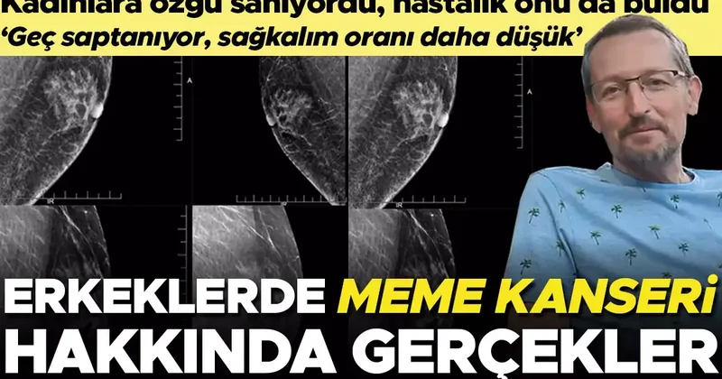 Bu hastalık kadınlara özgü sanıyordu, hiç beklemediği anda onu da buldu! Erkeklerde meme kanseri hakkındaki gerçekler… ‘Geç saptanıyor, sağkalım oranı daha...