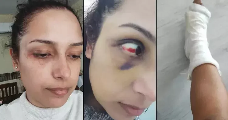 Adana da genç öğretmenin hayatı kabusa döndü! Hamileyken dövdü, ayağım kırıldı, bebeğimi kaçırdı