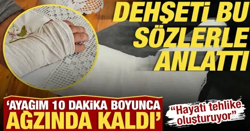 Başıboş sokak köpeğinin saldırısına uğrayan adamın ayağı 2 yerden kırıldı