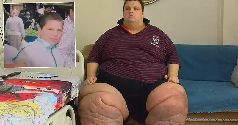 270 kilo Mehmet: 15 aydır evden çıkamıyorum, yardım edin