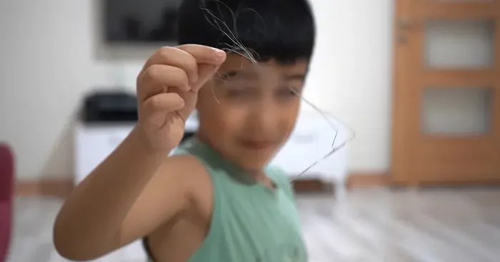 3 yıl sonra ortaya çıktı: 18 santimlik katerer unutmuşlar! Salatalık yutunca ortaya çıktı