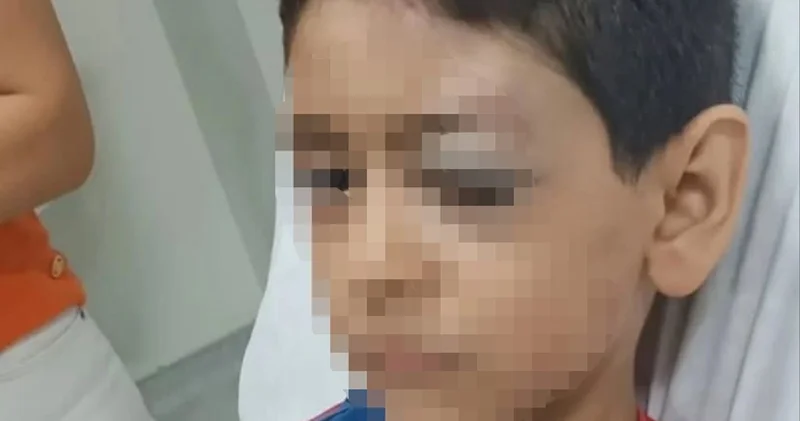 Polis memuru, oğluyla tartışan küçük çocuğu hastanelik etti