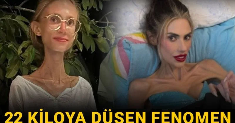 22 kiloya düşen fenomen hayatını kaybetti: Akıllara Nihal Candan geldi