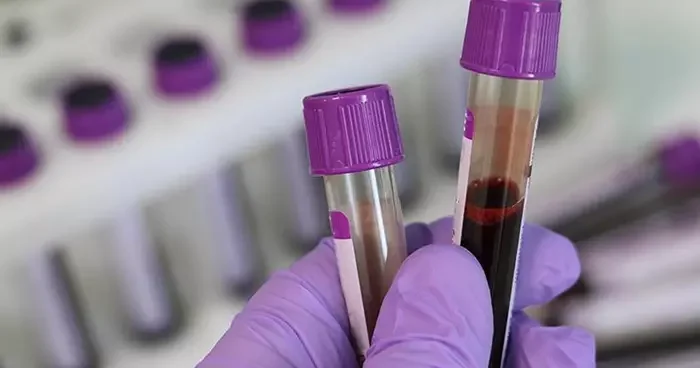 Genetik tehlike... Evlenmeden önce test şart: Talasemi sessizce yayılıyor! Uzmanlar uyardı: Talasemi taşıyıcılık oranı yüzde 2,1