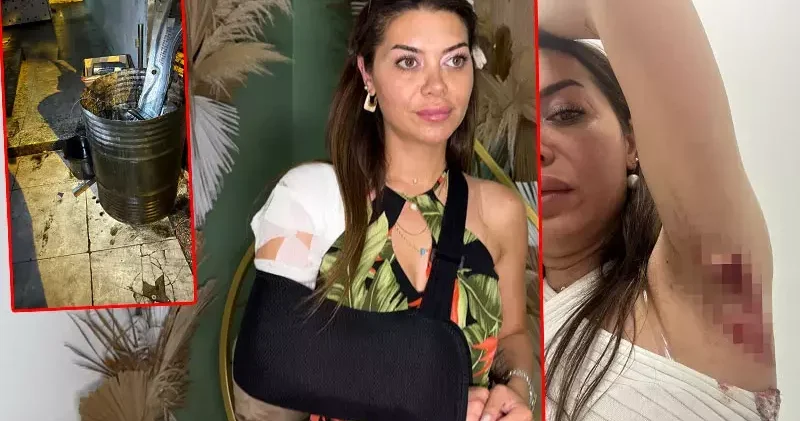 Avcılar da tamirhane önündeki motor yağı nedeniyle kayıp yaralandı; dava açtı
