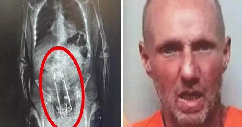 Hapishane girişinde fark edildi! X Ray de ortaya çıkan gerçek polislerin ağzını açık bıraktı