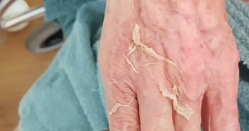 Yaşlı Bakımında Ölüme Neden Olma Davası