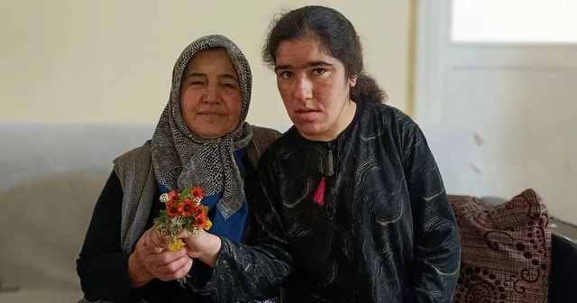 Ömrünü zihinsel engelli kızına adadı Kayseri Haberleri