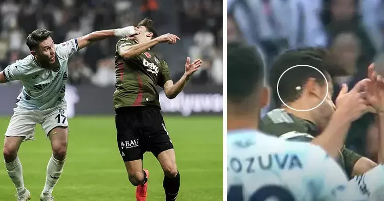 Beşiktaş ta sakatlıklar tat kaçırdı! Yıldız oyuncunun dişi kırıldı