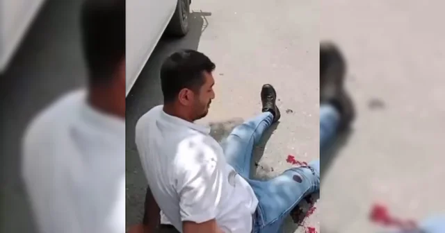 Kendisini rahatsız eden kişiyi ayaklarından vuran Nuray, o anları kayıt altına aldı Malatya Haberleri