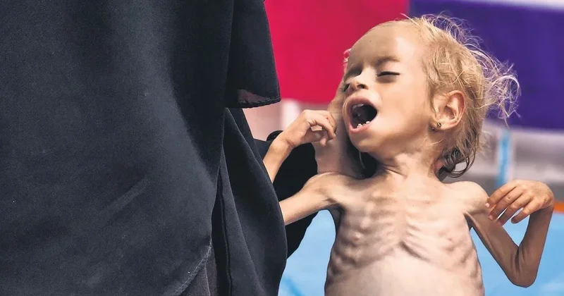 SON DAKİKA Dünyanın Gazze utancı! İsrail çocuk demeden katlediyor insanlık seyrediyor