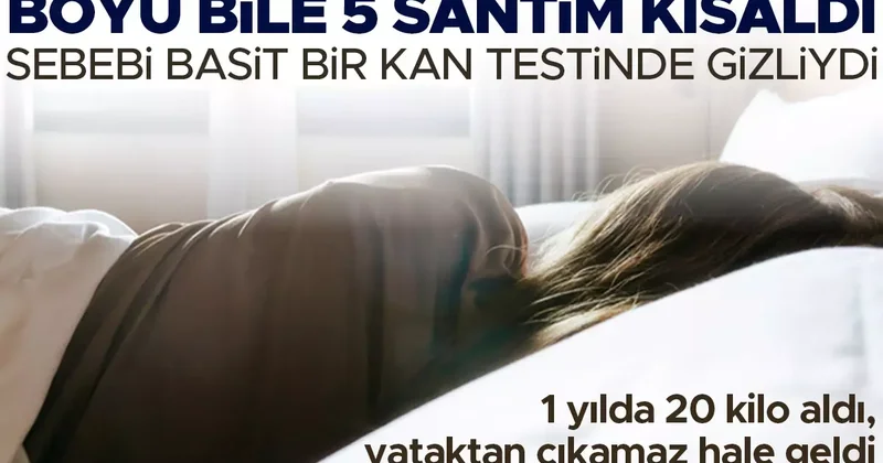 1 yılda 20 kilo aldı, yataktan çıkamaz hale geldi... Boyu bile 5 santimetre kısaldı! Sebebi basit bir kan testinde gizliydi
