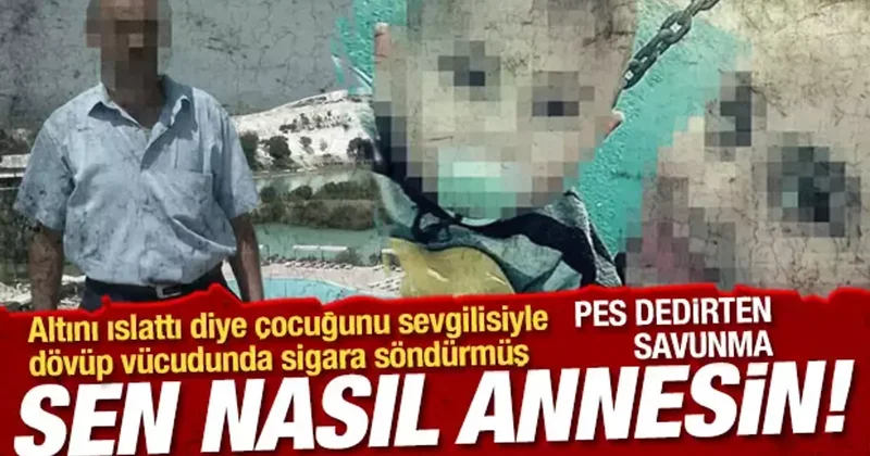 Altını ıslattığı için 3,5 yaşındaki çocuğu dövüp, vücudunda sigara söndürmüşler