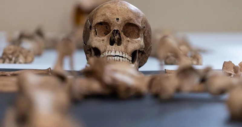 Avustralya da bir üniversitenin 25 yıl boyunca izinsiz beden parçaları topladığı belirlendi