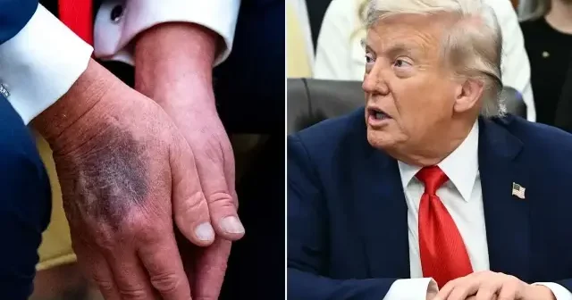 Trump ın kalp yaşı 65 çıktı Amerika Haberleri