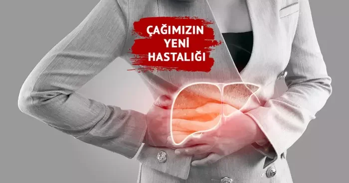 Çağın yeni hastalığı: Karaciğer yağlanması! Son 30 40 yılda giderek artıyor! Karaciğer yağlanması neden olur? Uzmanlardan uyarılar...