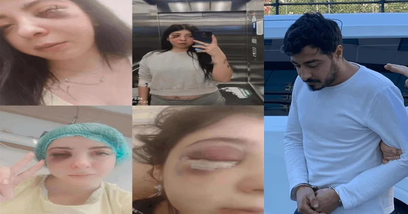 Sokak ortasında dövülen Damla üzen gerçeği anlattı Sözcü Gazetesi