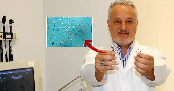 Yanlışlıkla yutulanlar koleksiyonunda yok yok! Oyuncak, çatal, toka...