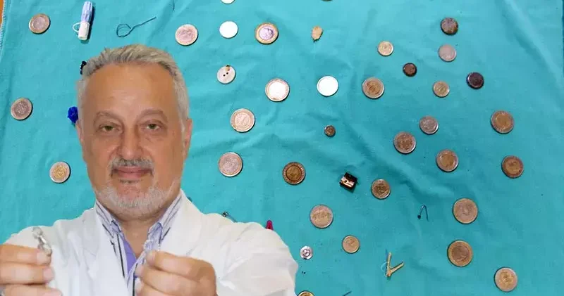 Profesörün, yanlışlıkla yutulanlar koleksiyonu