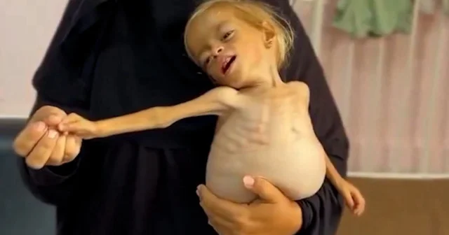 Gazze’de çocuklar açlıktan ölüyor VİDEO İZLE