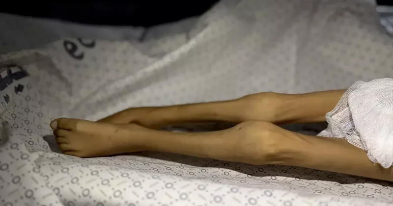 Gazze Şeridi nde bir çocuk daha açlıktan öldü! 3 kiloya kadar düşmüştü