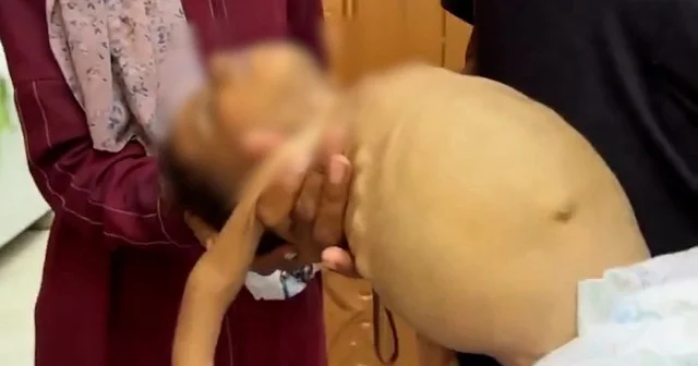 İsrail’in ablukası Gazze’yi açlığa sürüklüyor: 6 yaşındaki Filistinli Cemal açlıktan hayatını kaybetti VİDEO İZLE