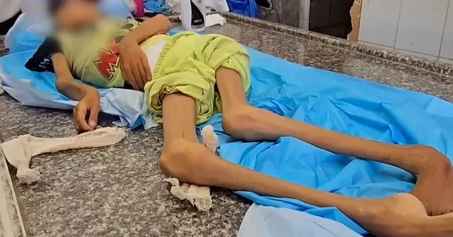 Gazze’de yetersiz beslenme nedeniyle 10 yaşındaki Amine hayatını kaybetti VİDEO İZLE