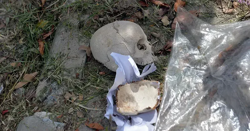 Çöpte bulunan kafatasını, uzman doktorun temizlik yapan eşi atmış
