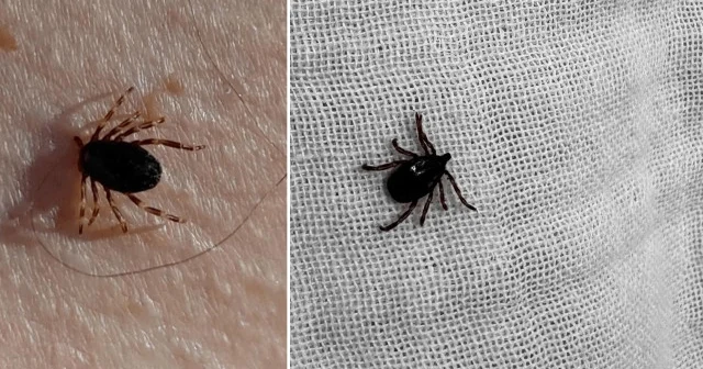 Kırıkkale de KKKA vakası: Vücuduna yapışan keneyi çıkartan çocuğun testi pozitif çıktı Kırıkkale Haberleri