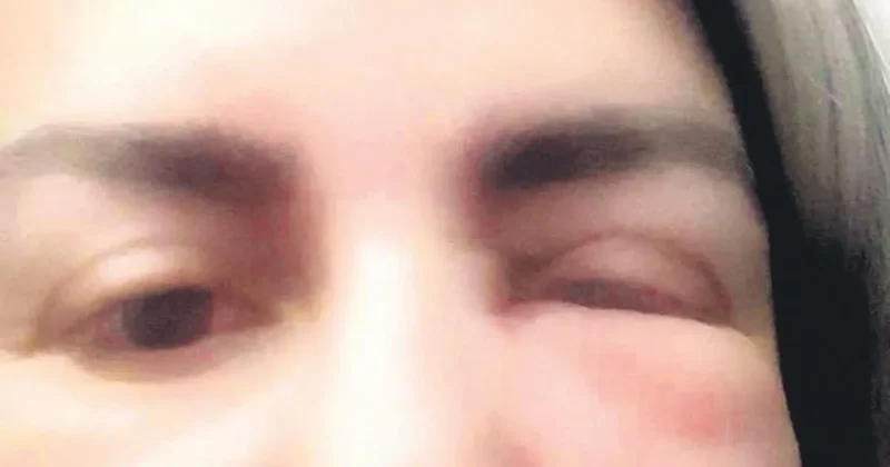 Güzelleşmek için gitti tanınmaz hâle geldi
