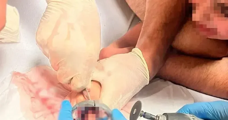 Parmağını musluk aynasına sıkıştıran 5 yaşındaki çocuğu itfaiye kurtardı