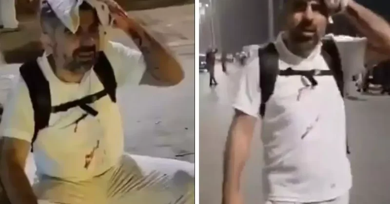 Gazze için yürüyenlere Mısır da müdahale! HÜDA Par Milletvekili başından yaralandı