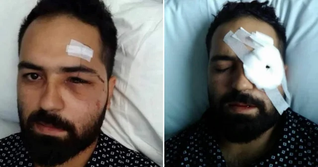 15 Temmuz da Genelkurmay Başkanlığı önünde vurulan gazi Akkoç: Darbeci asker dalga geçer bir ses tonu ile ‘sen kelime i şehadet getir dedi Gündem Haberleri