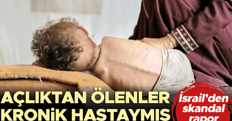 İsrail’den skandal rapor… Açlıktan ölenler kronik hastaymış