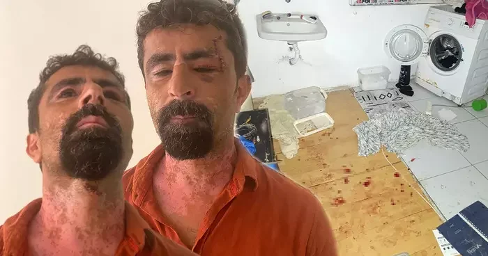 Antalya da öfkeli damat dehşeti: Karısı terk edince kayınpederini hastanelik etti