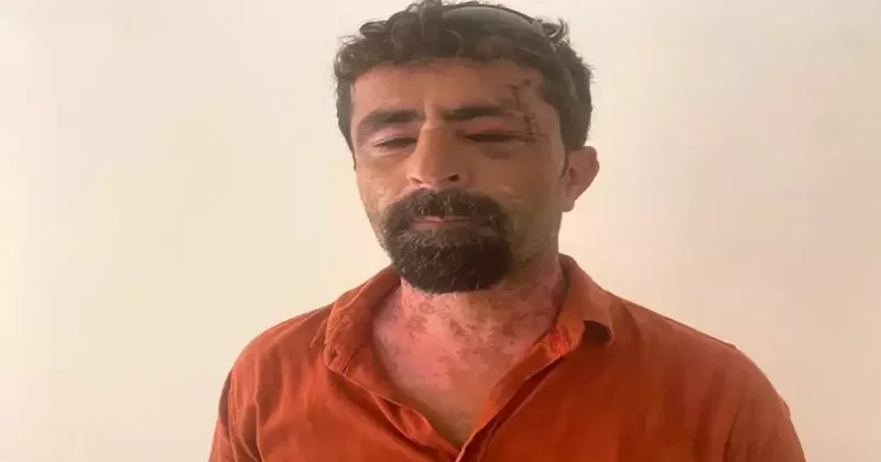 Antalya da damat dehşeti: Kayınpederini hastanelik etti! Pencere camı detayı kan dondurdu