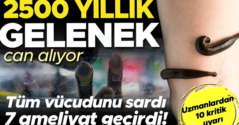 2500 yıllık gelenek can alıyor! Enfeksiyon tüm vücudunu sardı, 7 ameliyatla hayata döndü! Uzmanlardan kritik 10 uyarı