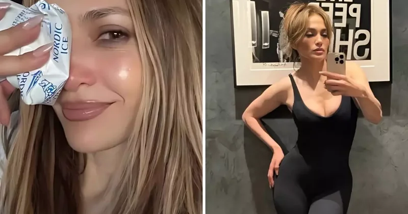Jennifer Lopez, Amerikan Müzik Ödülleri provaları sırasında yüzünden yaralandı