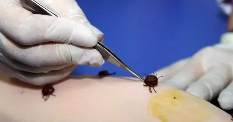 Dünyanın dört bir yanında görülüyor... Lyme hastalığı ‘ABD’nin biyolojik silahı mı?