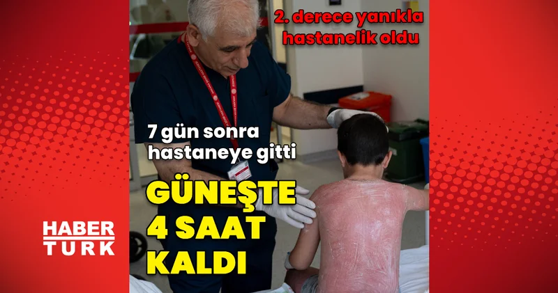 Güneşte 4 saat kalan çocuk, ikinci derece yanıkla hastanelik oldu Haberler Sağlık Haberleri