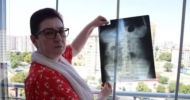 Kayseri haberleri Ameliyat skandalı! 22 yıldır canlı bomba gibi geziyor 14 Ağustos 2025