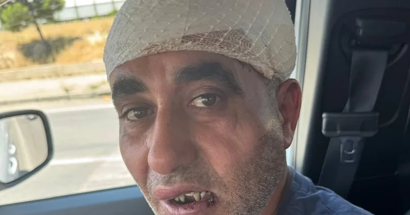 Eğlenmeye gitti, kabusu yaşadı: Önce tekme ve sopalarla darp edildi, ardından gasp edildi Sözcü Gazetesi