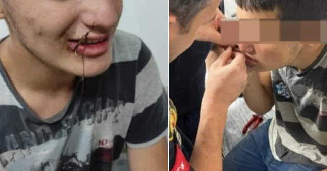 Oltaya bu kez çocuk takıldı: Balık iğnesiyle oynayan çocuğu itfaiye kurtardı Aktüel Haberleri