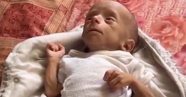 Gazzeli bebekler açlıkla savaşıyor: O görüntüler yürekleri dağladı VİDEO İZLE