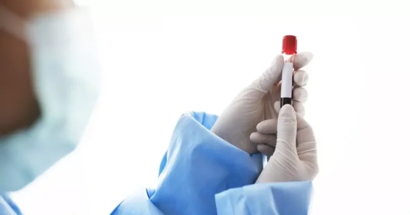 Sepsis her yıl 11 milyon insanı öldürüyor: İşte belirtiler ve korunma yolları