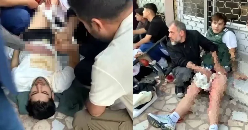 İnternet kafede çıkan kavgada 2 kişi bıçaklandı
