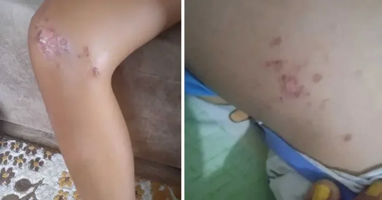 Denizden çıkan çocuk bir anda fenalaştı, korkunç gerçek muayenede öğrenildi İğrenç görüntüye tepki yağdı